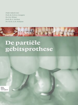 cover image of De partiële gebitsprothese